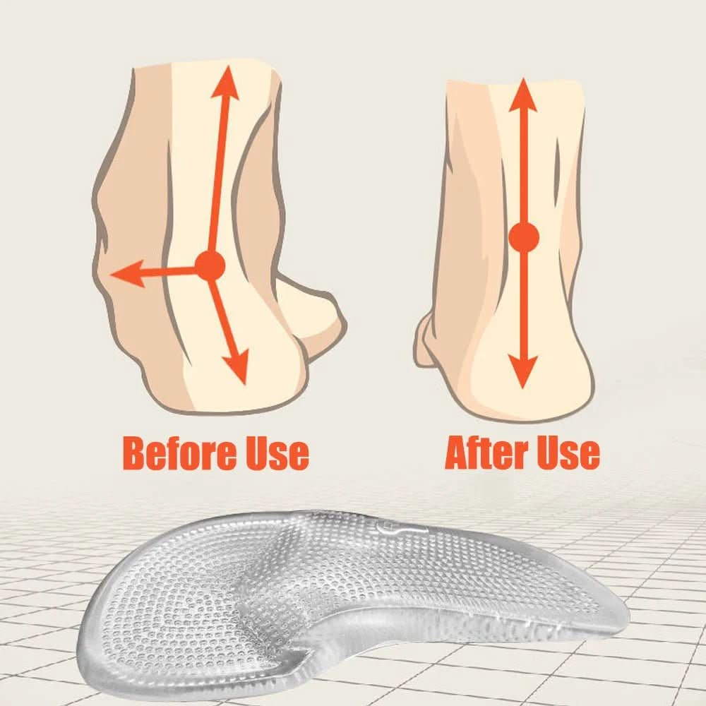 ARCHCRADLE – Orthopädische Gel-Einlegesohlen für stützenden Halt des Fußgewölbes - sellene.de