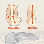 ARCHCRADLE – Orthopädische Gel-Einlegesohlen für stützenden Halt des Fußgewölbes - sellene.de