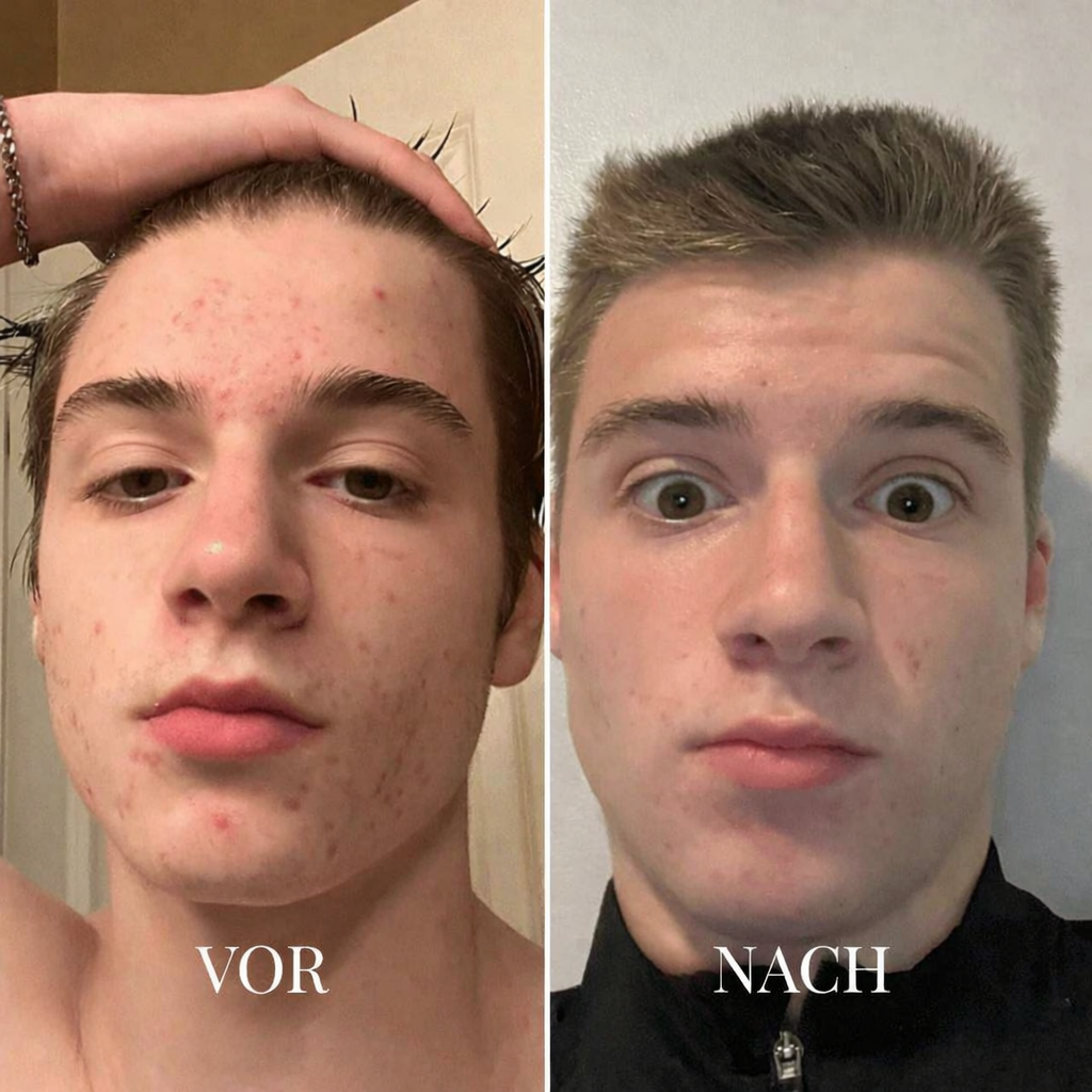 Porevia™ Vakuumreiniger - sellene.de