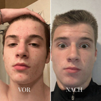 Porevia™ Vakuumreiniger - sellene.de