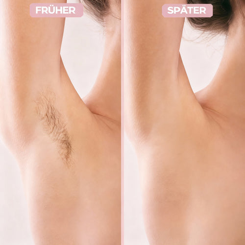 Sellene™ 2-in-1 SmoothShaver