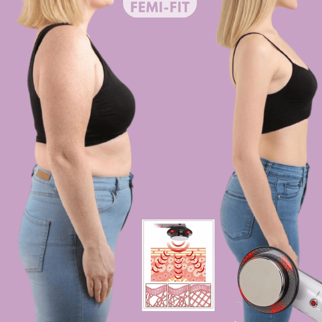 SlimShape – 3-in-1 Cellulite- & Fettbrenner mit EMS, Ultraschall & Infrarotlicht - sellene.de