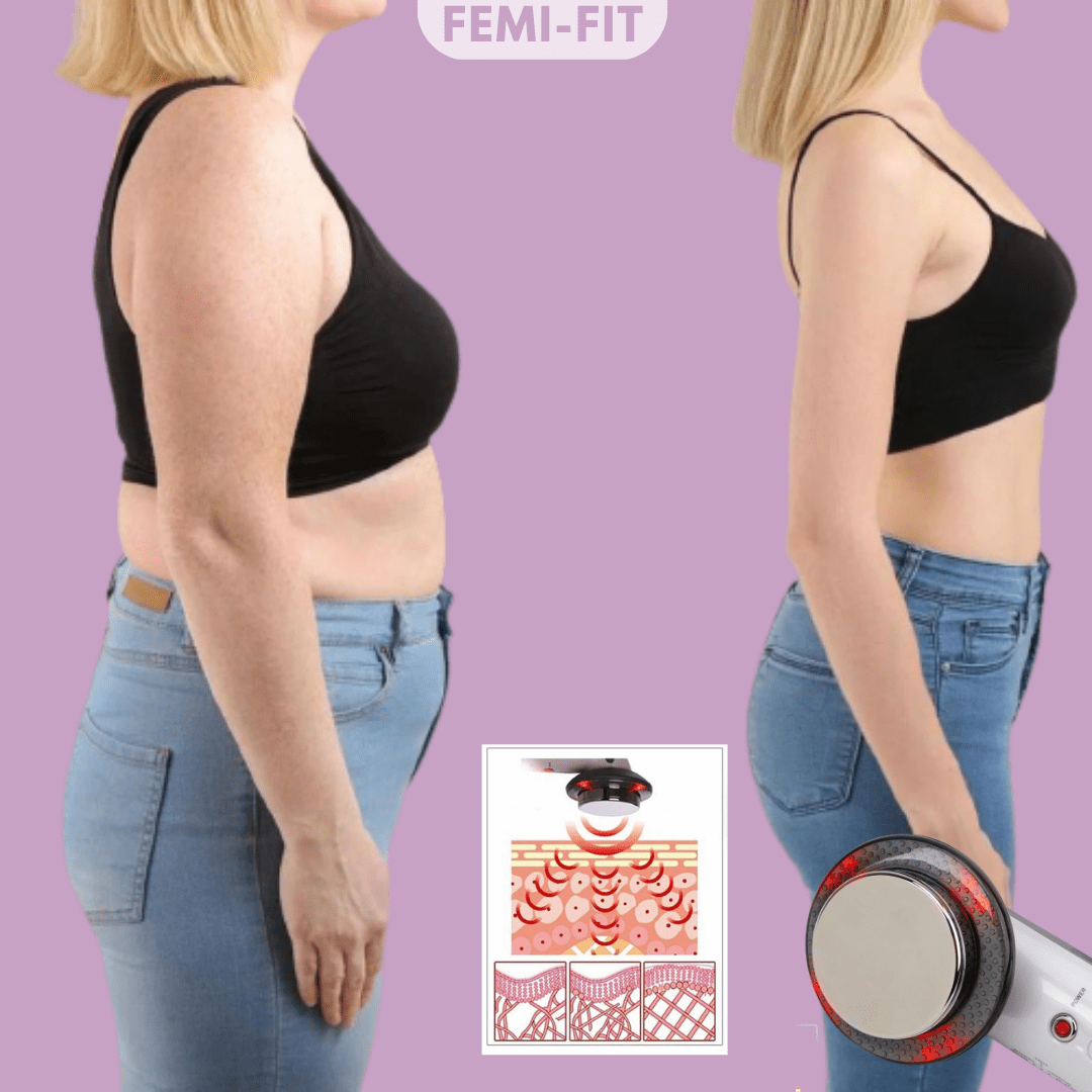 SlimShape – 3-in-1 Cellulite- & Fettbrenner mit EMS, Ultraschall & Infrarotlicht - sellene.de