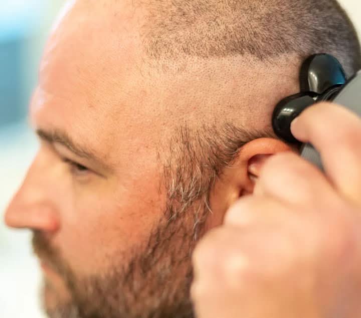 SmoothTrim – 5-in-1 Rasierer mit flexiblem Scherkopf & Zubehör - sellene.de