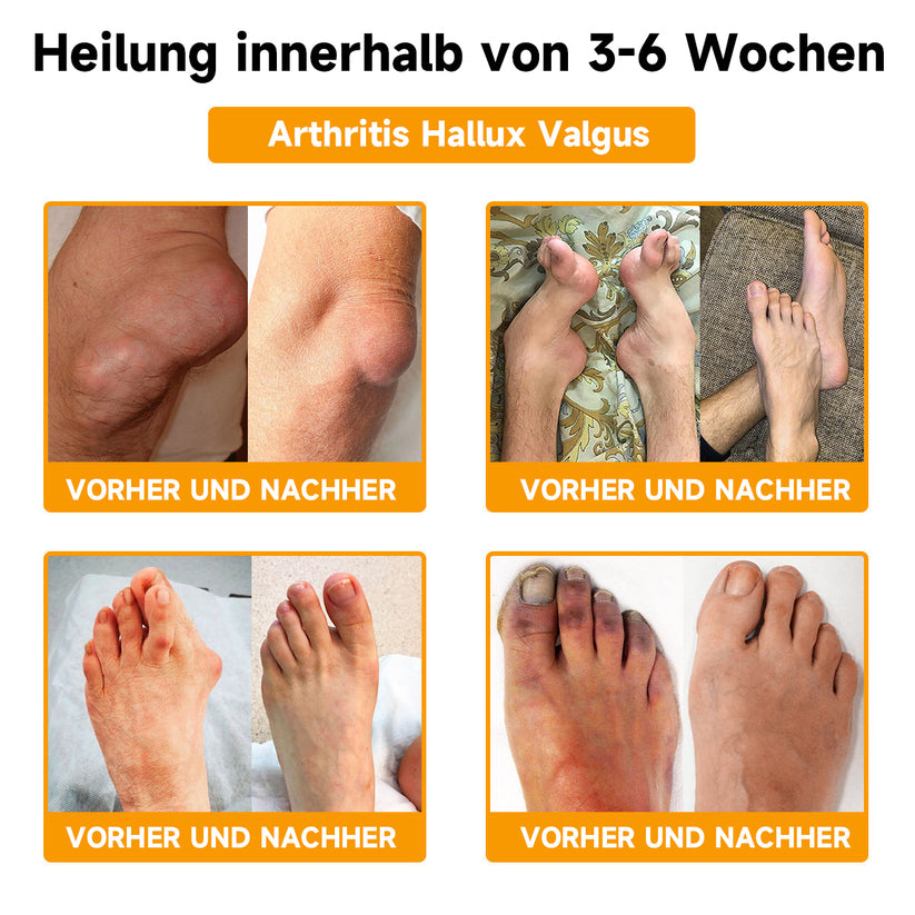 Bienengiftcreme | Salbe mit Bienengift, Hyaluron & Kollagen | BeeLixir - sellene.de