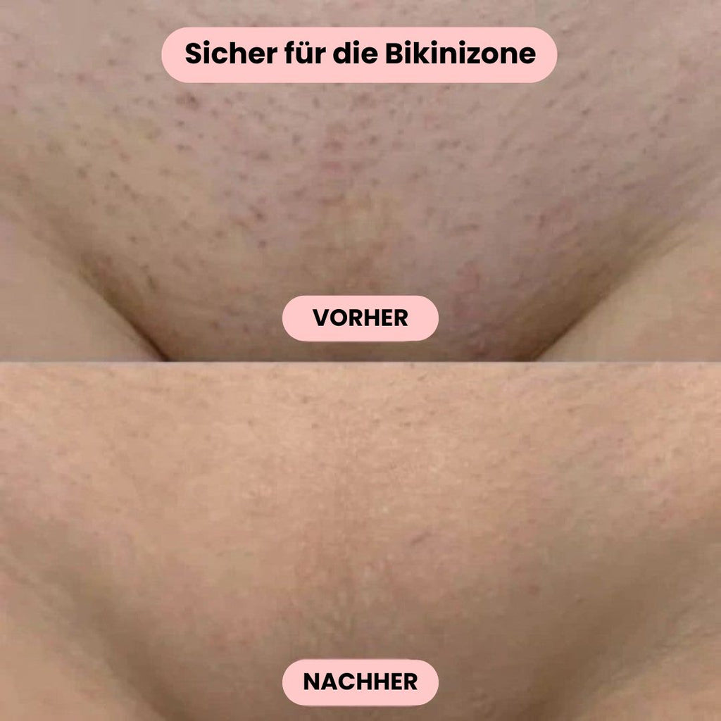 Intimrasierer Frauen | Elektrischer Rasierer für Damen | IntimLisse - sellene.de