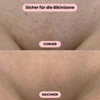 Intimrasierer Frauen | Elektrischer Rasierer für Damen | IntimLisse - sellene.de