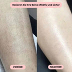 Intimrasierer Frauen | Elektrischer Rasierer für Damen | IntimLisse - sellene.de