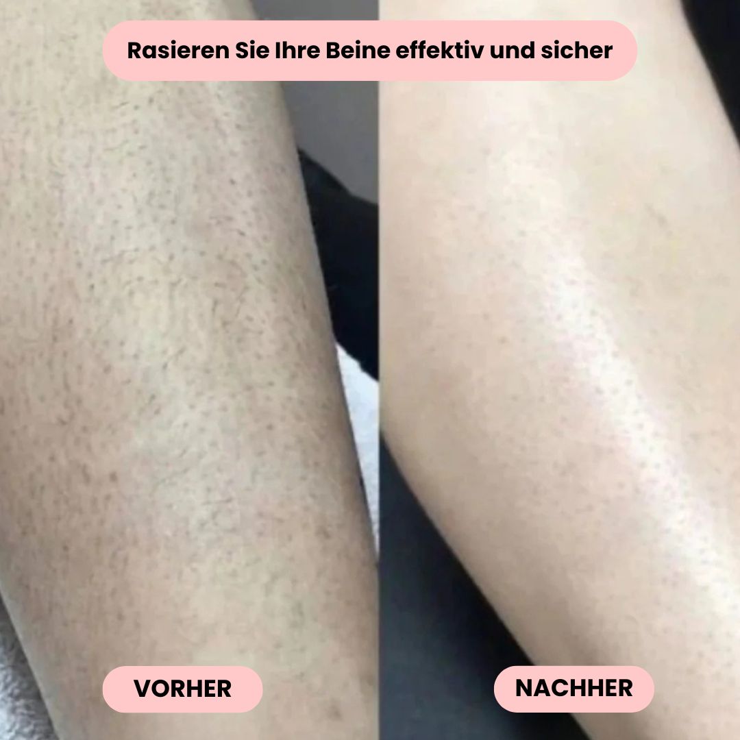 Intimrasierer Frauen | Elektrischer Rasierer für Damen | IntimLisse - sellene.de