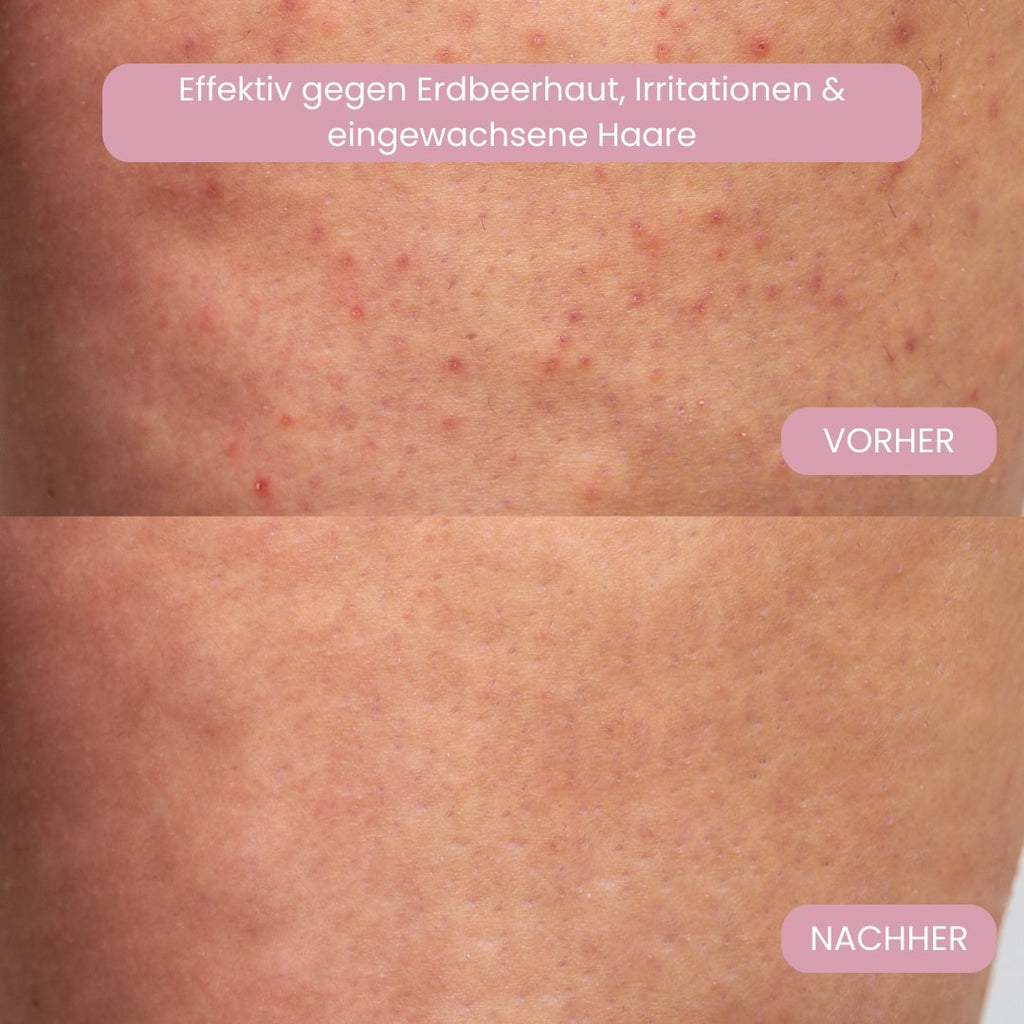 Intimrasierer für Frauen | Elektrischer Damenrasierer für Intimbereich | Bikini Trimmer | Femora - sellene.de