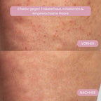 Intimrasierer für Frauen | Elektrischer Damenrasierer für Intimbereich | Bikini Trimmer | Femora - sellene.de