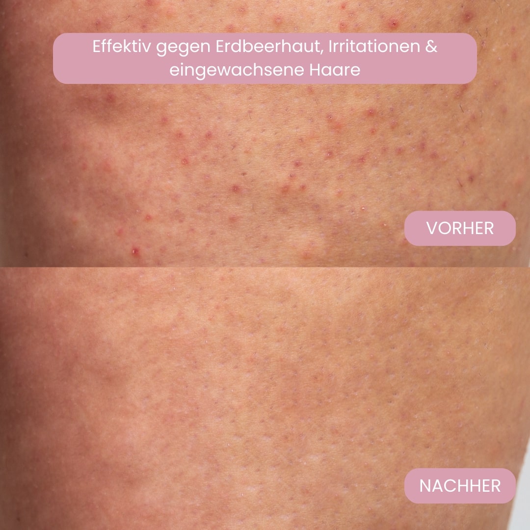 Intimrasierer für Frauen | Elektrischer Damenrasierer für Intimbereich | Bikini Trimmer | Femora - sellene.de