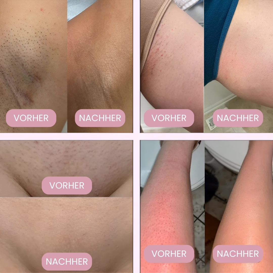 Intimrasierer für Frauen | Elektrischer Damenrasierer für Intimbereich | Bikini Trimmer | Femora - sellene.de