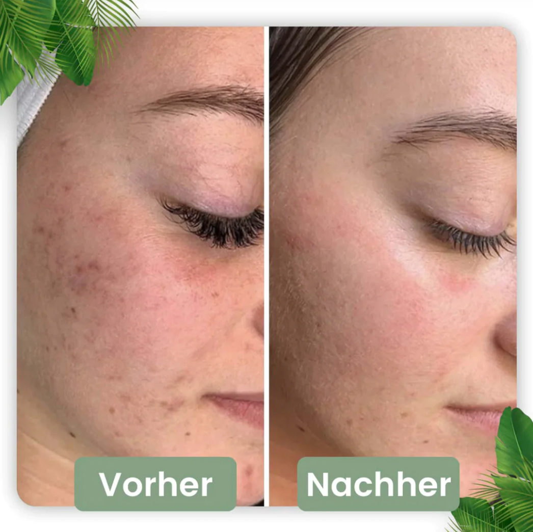Reinigungsmaske Stick für Gesichtsreinigung | Naturkosmetik mit Grünteeextrakt für Hautpflege | LumiHaut - sellene.de