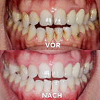 Mineralpulver für Zahnpflege | Zähne Stärken & Schützen | SmileSchutz - sellene.de