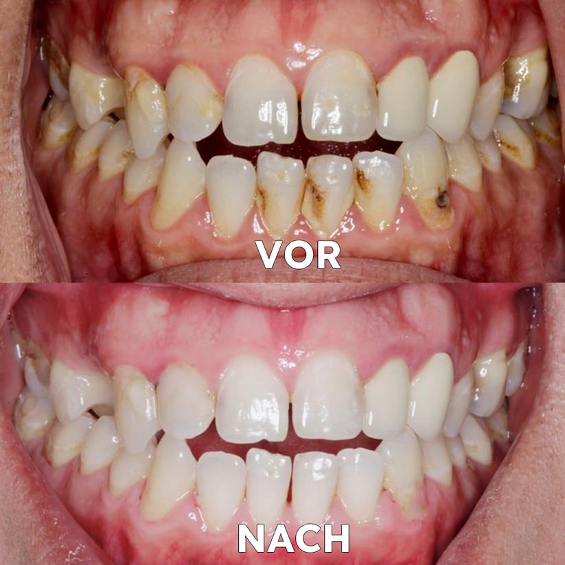 Mineralpulver für Zahnpflege | Zähne Stärken & Schützen | SmileSchutz - sellene.de