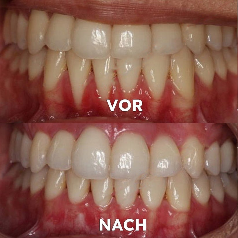 Mineralpulver für Zahnpflege | Zähne Stärken & Schützen | SmileSchutz - sellene.de