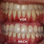 Mineralpulver für Zahnpflege | Zähne Stärken & Schützen | SmileSchutz - sellene.de