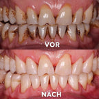 Mineralpulver für Zahnpflege | Zähne Stärken & Schützen | SmileSchutz - sellene.de