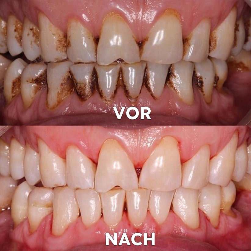 Mineralpulver für Zahnpflege | Zähne Stärken & Schützen | SmileSchutz - sellene.de