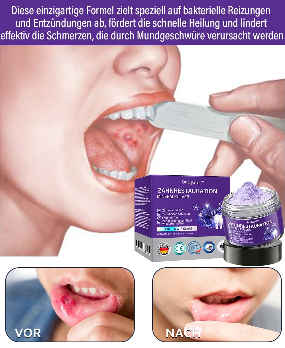 Mineralpulver für Zahnpflege | Zähne Stärken & Schützen | SmileSchutz - sellene.de